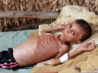 Εκατοντάδες χιλιάδες παιδιά θα πεθάνουν από πείνα λόγω της πανδημίας