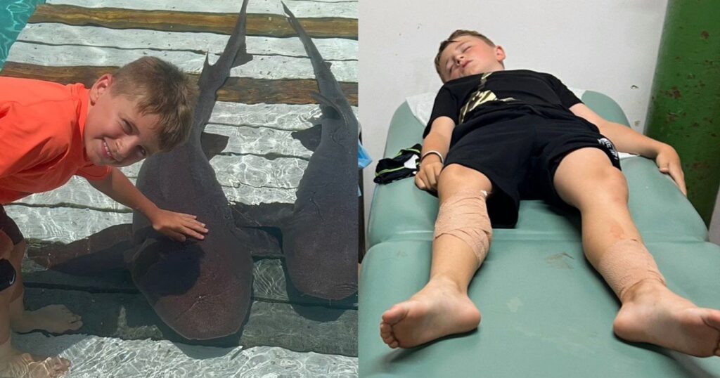 «Άκοuσα ουpλιαχτό, ήταν πολύ το αίμα»: 8χpονος δέχθηκε επίθεση από καρχαρίες – Τον έσωσε η 12χρονη αδερφή του