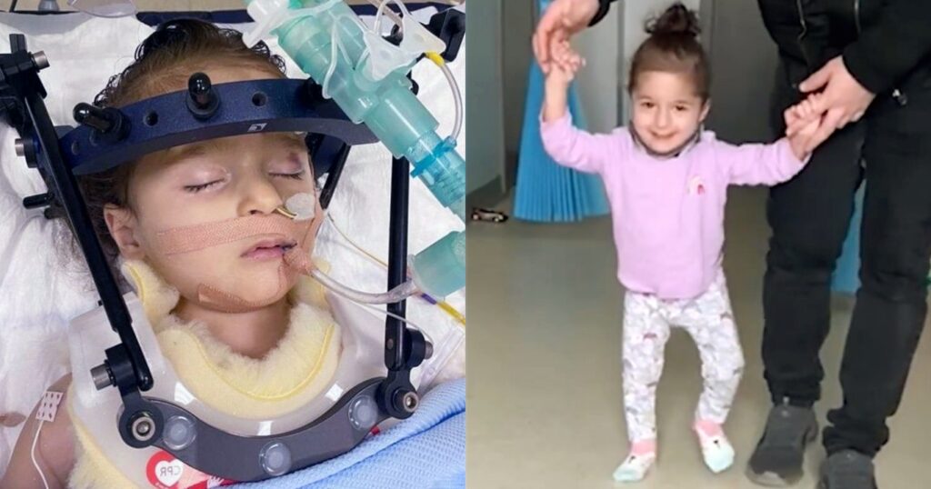 Κοριτσάκι περπατά ξανά 3 μήνες μετά από τροχαίο δυστύχημα που διέλυσε την σπονδυλική του στήλη