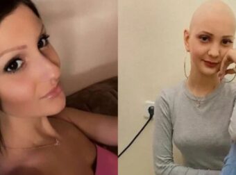 “Θα μου άνοιγαν όλο το πρόσωπο”: Γολγοθάς για τη Νεφέλη Γαβαλάκη, η μάχη της πρώην εστεμμένης & η σπάνια πάθηση