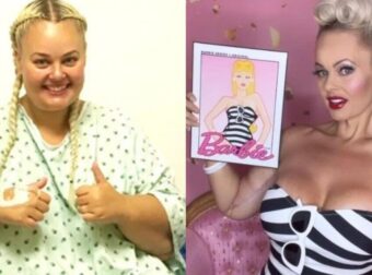 Πήρε ακόμα και προαγωγή: 37χρονη έχασε 92 κιλά για να μοιάσει στη Barbie -“Έκανα το όνειρό μου πραγματικότητα”