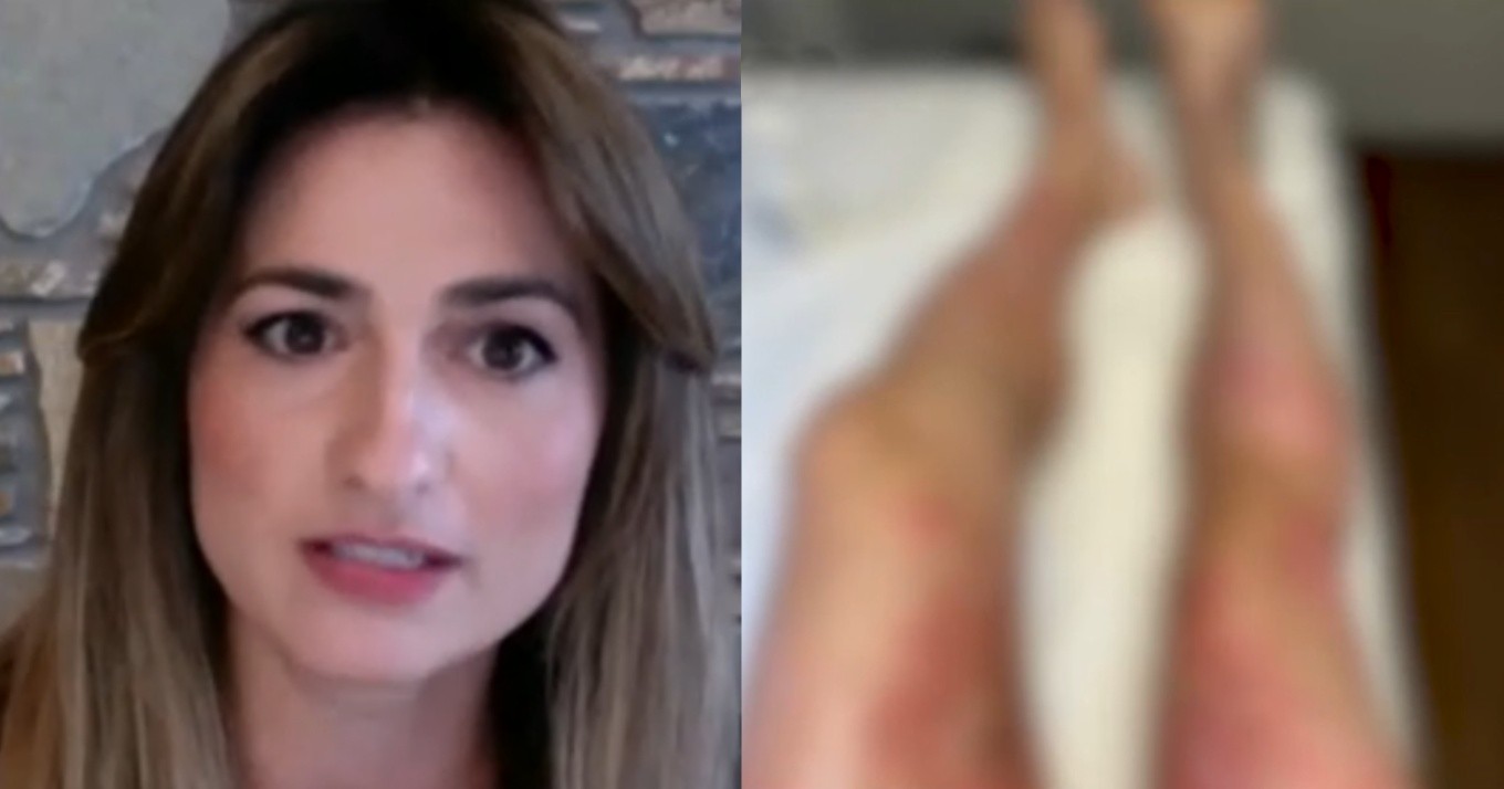 Το μαρτύριο της 35χρονης Στέλλας: «Το αποφρακτικό υγρό δεν έκαψε μόνο το σώμα μου αλλά και την ψυχή μου»