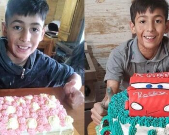 Συγκινεί το διαδίκτυο: 10χρονος με σοβαρά εγκαύματα φτιάχνει γλυκά για να πληρώσει τις επεμβάσεις του μόνος του