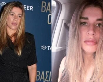 3 χρόνια μετά τον ακρωτηριασμό: Συγκλονίζει η Έρρικα Πρεζεράκου – Η φωτο με το χέρι της & το δυνατό μήνυμα