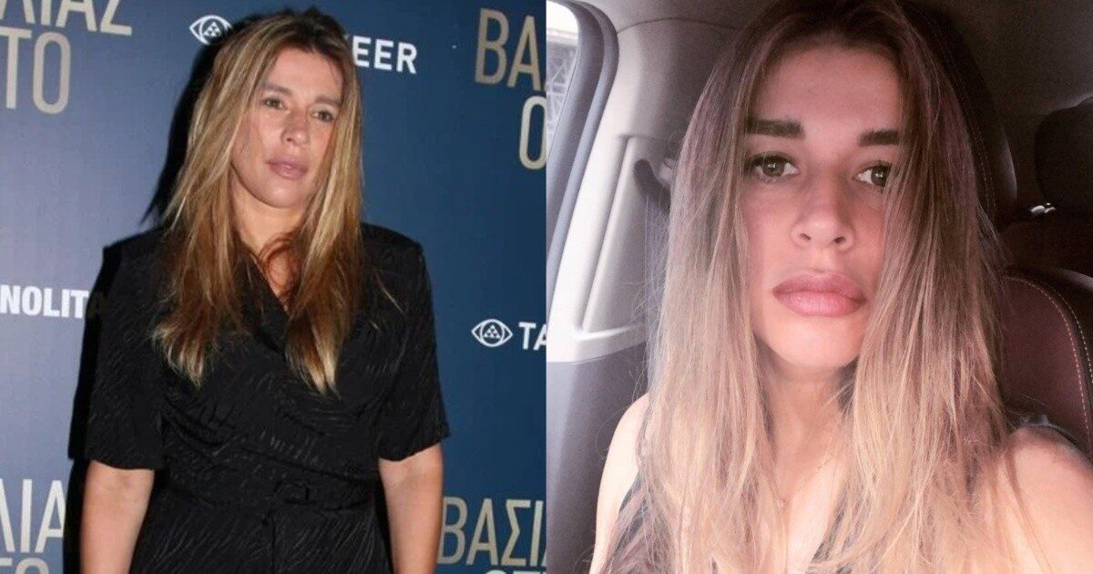 3 χρόνια μετά τον ακρωτηριασμό: Συγκλονίζει η Έρρικα Πρεζεράκου – Η φωτο με το χέρι της & το δυνατό μήνυμα