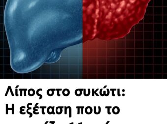 Λίπος στο συκώτι: Η εξέταση που το εντοπίζει 16 χρόνια πριν από τα συμπτώματα