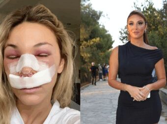 Χρύσα Χατζηγεωργίου: Χαμός στο TikTok με την πλαστική στη μύτη της–«Εσύ είσαι ο κανένας που θα…»