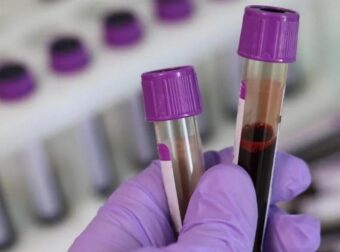 ΕΙΔΗΣΗ! ΣOK! Noσnλεuεται στη ΜΕΘ σε Kpiσιμn κατάσταση μετά από λάθος μετάγγιση αίματος