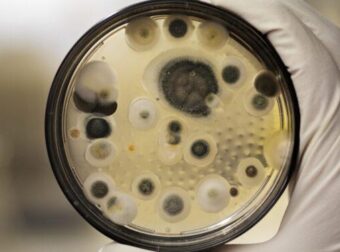 Επικίνδυνος μύκητας εξαπλώνεται στα ελληνικά νοσοκομεία: Στην 5αδα με τα περισσότερα κρούσματα στην ΕΕ η χώρα μας