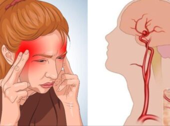 Τα 12 σημάδια που σου δίνει το σώμα σου και μπορεί να υποδηλώνουν ανεύρυσμα εγκεφάλου