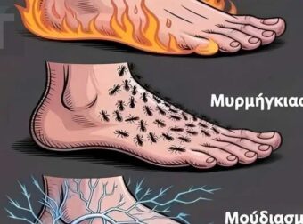Όταν τα πόδια στέλνουν προειδοποιητικά σήματα – Τι σημαίνουν κάψιμο, μυρμήγκιασμα και μούδιασμα