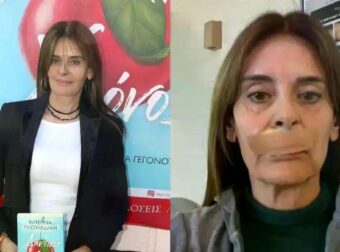 Πλουμιδάκη: Υποβλήθηκε στο 21ο χειρουργείο – «Πήραν λίπος από τον γλουτό για τη συγκεκριμένη επέμβαση»