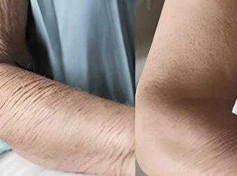 Πώς να φροντίσετε το δέρμα που γερνάει – Τα λάθη που κάνουμε και μας μεγαλώνουν