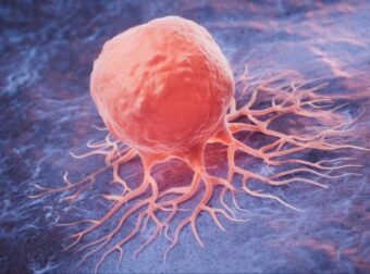 O καρκίνος… φοβάται μόλις αρχίσεις να τρως αυτές τις 8 τροφές, ήρθε η ώρα να τις προσθέσεις στην διατροφή σου – Δες ποιες είναι