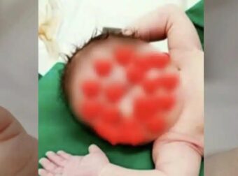 Λάρισα: Πώς έπεσε το καυτό λάδι πάνω στο σωματάκι του 18 μηνών βρέφους που μετά έπαθε ανακοπή