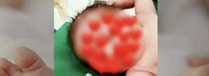 Λάρισα: Πώς έπεσε το καυτό λάδι πάνω στο σωματάκι του 18 μηνών βρέφους που μετά έπαθε ανακοπή