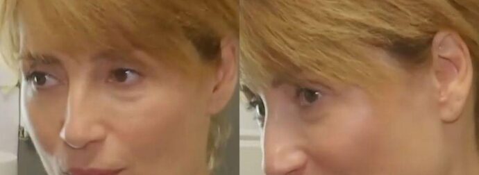 Ανnσυxία για την ηθοποιό Ευδοκία Ρουμελιώτη: Αυτό είναι το αυτοάνοσο με το οποίο διαγνώστnκε