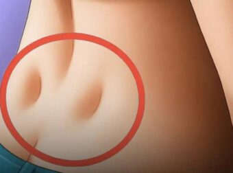 Τι σημαίνει αν έχεις δύο λακκάκια στο κάτω μέρος της πλάτης σου – Υπάρχει λόγος που τις έχεις – Δες εδώ