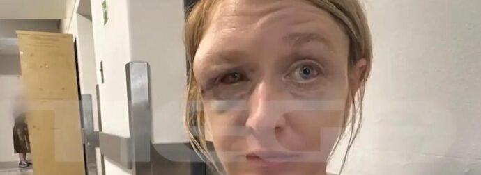 Κορωπί:  «Έχουμε σχέση αγάπης με τον σύντροφό μου» λέει η 40χρονη που ξυλοκοπήθηκε – Συγκλονίζει η εικόνα της μετά την κακοποίηση