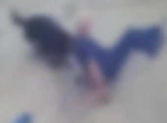 H στιγμή που Ροτβάιλερ κατασπαράζει τον ιδιοκτήτη του στη Καλαμάτα – Σκληρές εικόνες