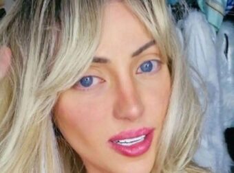 Θλίψη στη Βραζιλία: Νεκρή influencer που έκανε 27 πλαστικές επεμβάσεις για να μοιάσει στη Barbie