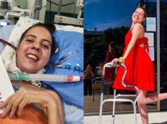 Πέθανε η Αναστασία Τασούλα, η πρώτη ασθενής με κυστική ίνωση στην Ελλάδα που είχε ξυπνήσει μετά από 221 μέρες