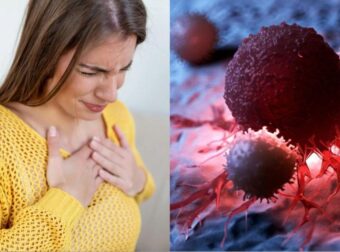 Καpκίνος: Τα τέσσερα απρόσμενα συμπτώματα που πρέπει όλοι να γνωρίζουμε