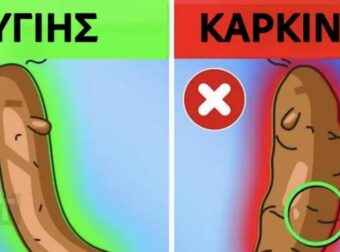 Τι αποκαλύπτει το χρώμα των κοπράνων σας για την υγεία σας