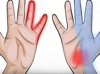 Μούδιασμα χεριών: Τα συμπτώματα που δεν πρέπει ποτέ να αγνοήσετε