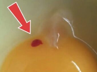 Πρέπει να τρώμε αυγά με κηλίδες αίματος;