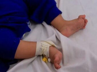 Τραγωδία: Μωρό 13 μηνών υπέστη καρδιακή προσβολή και έκαψε τη μισή του γλώσσα – Ήπιε κατά λάθος καθαριστικό υγρό