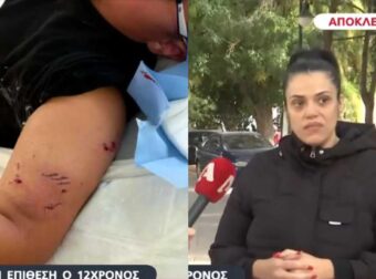 Σκύλος δάγκωσε 12χρονο έξω από Δημοτικό Σχολείο – Τι κατήγγειλε η μητέρα του για τον ιδιοκτήτη;