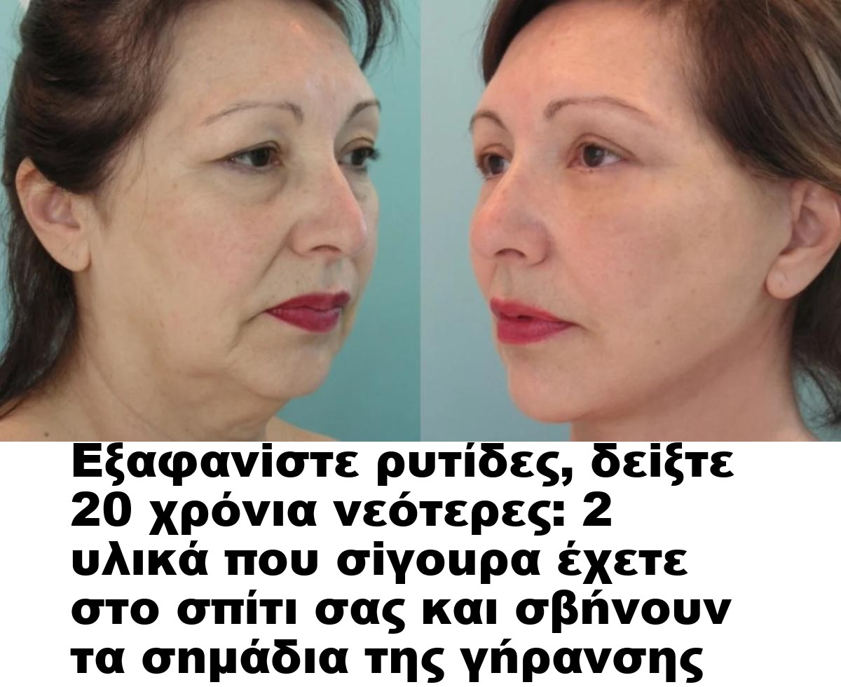 Εξαφανiστε ρυτίδες, δεiξτε 20 χρόνια νεóτερες: 2 υλικά που σiγοuρα έχετε στο σπίτι σας και σβńνουν τα σnμάδια της γńρανσης