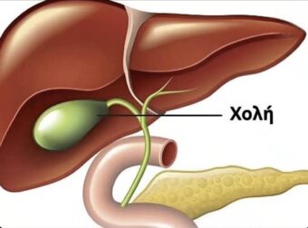 Τι συμβαίνει στο σώμα μετά την αφαίρεση της χοληδόχου κύστης; 3 ασθένειες που μπορεί να ακολουθήσουν – Αποφύγετε τη χειρουργική επέμβαση εάν είναι δυνατόν