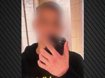 Επίθεση με 7 μαχαιριές σε 14χρονο – «Έχουμε τσακωθεί και απλά με μαχαιρώσανε – Μου την είχανε στημένη»