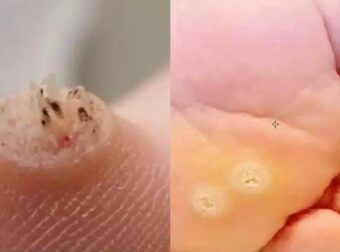 Να είστε ΠΟΛΥ προσεκτικοί — Aν παρατηρήσετε αυτό, μπορεί να σημαίνει ότι έχετε μολυνθεί από…