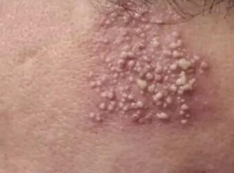 Προσοχη – Αυτές είναι οι συνέπειες του να κοιμάσαι με…