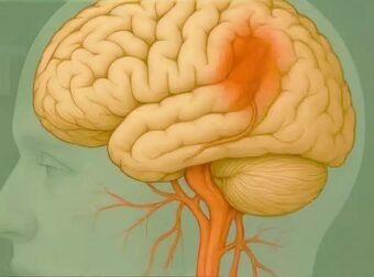 Αιφνίδια σύγχυση ή δυσκολία στην ομιλία: Όταν δεν είναι απλώς κούραση