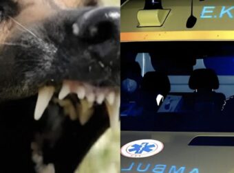 Της επιτέθηκε σκύλος και της έκοψε δύο δάχτυλα – Νύχτα τρόμου ανήμερα τα Χριστούγεννα