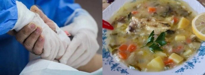 Το δείπνο κατέληξε σε τραγωδία: Πήγε επίσκεψη σε φίλους, έφαγε ψαρόσουπα και πέθανε μαρτυρικά 35 ημέρες μετά