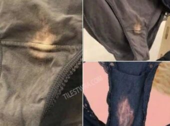 Τι σημαίνει αν δείτε ένα ξεθωριασμένο μέρος στο εσώρουχό σας