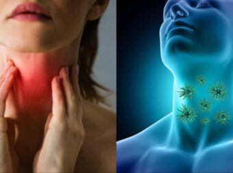 «Μυστηριώδης ιός του λαιμού» σαρώνει τον πλανήτη: Τα συμπτώματα που πρέπει να προσέξετε πριν να είναι αργά