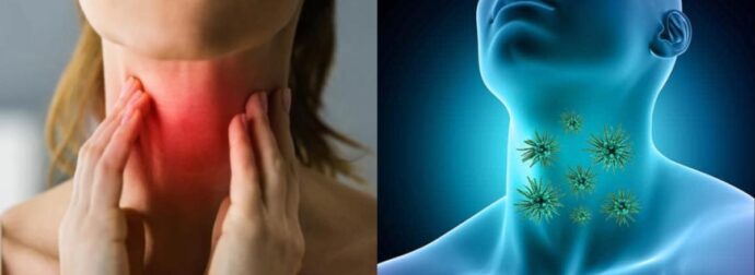«Μυστηριώδης ιός του λαιμού» σαρώνει τον πλανήτη: Τα συμπτώματα που πρέπει να προσέξετε πριν να είναι αργά