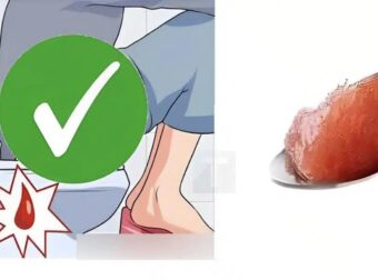 Για ανθρώπους με συχνή δυσκοιλιότητα – Μόνο ένα κουταλάκι από αυτό το πρωί