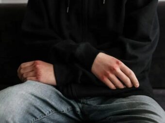 Πάτρα: Ο 16χρονος εξανάγκασε τον 15χρονο να γονατίσει και στη συνέχεια τον γρονθοκόπησε – Την επίθεση κατήγγειλε ο πατέρας του θύματος.