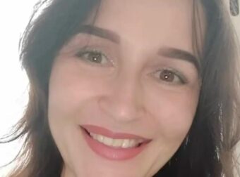 Φρίκη: 33χρονος «σταύρωσε» και έβαλε φωτιά στη σύντροφό του γιατί του ζήτησε να χωρίσουν – Σοκάρει φωτογραφία με το καμένο πρόσωπο της