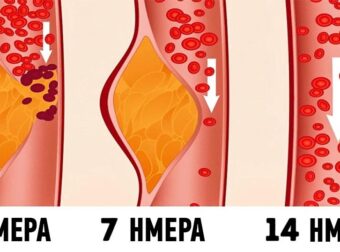 Τι είναι η δίαιτα ΝΤΑΣ και γιατί οι γιατροί την θεωρούν μια από τις καλύτερες για την υγεία