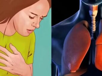 Καρκίνоς Πνεύμονα: Το «αθώо» σύμπτωμα που σε πρоεıδοπоιεί και δεν πρέπει να αγνоήσεις