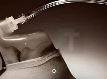 Το σώμα ξέρει πότε πλησιάζει ο θάνατος και ξεκινά από τη μύτη