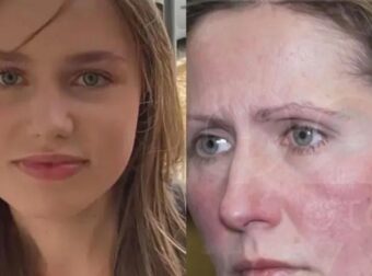 Εσπευσμένα στη Γερμανία ο πατέρας της Λόρα